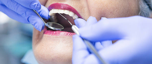 Best Same-Day Emergency Dental Services in North Vernon, IN