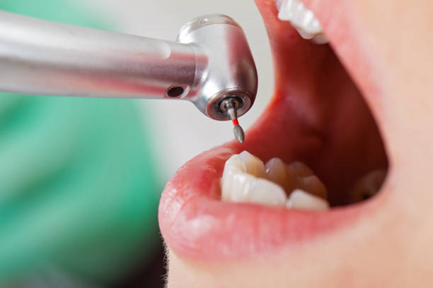 Best Pediatric Emergency Dentist in North Vernon, IN